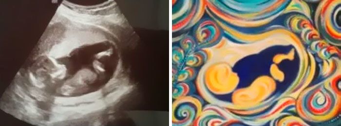 Многодетная мама создает красочные картины из УЗИ беременных женщин