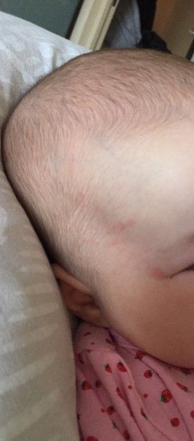Помогите не пойму это аллергия или нет Помогите не пойму это аллергия или нет