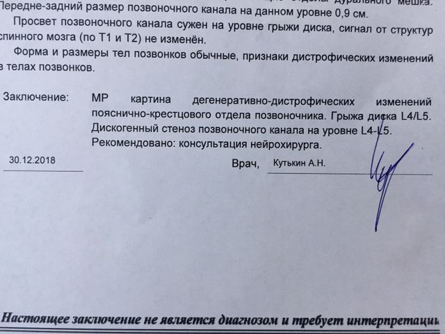 Грыжа позвоночника. Грыжа позвоночника.