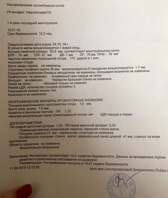 Первый скрининг пройден! Первый скрининг пройден!