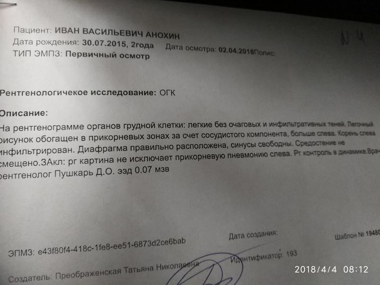 Mogut Li Byt Prichinoj Kashlya Adenoidy